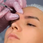 botox at northstar dermatology